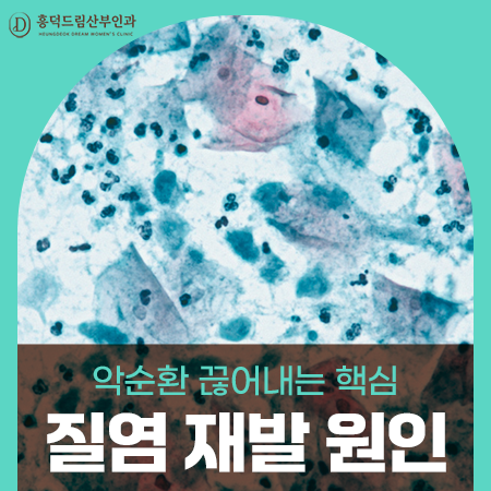 질염, 왜 자꾸 재발할까요? 원인부터 다시 짚어야 하는 이유