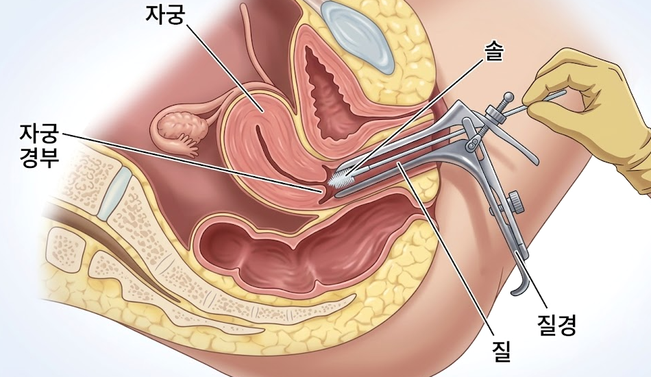 자궁경부암검진 결과 '반응성 세포변화', 무슨 뜻일까? 관련 해부 구조 그림