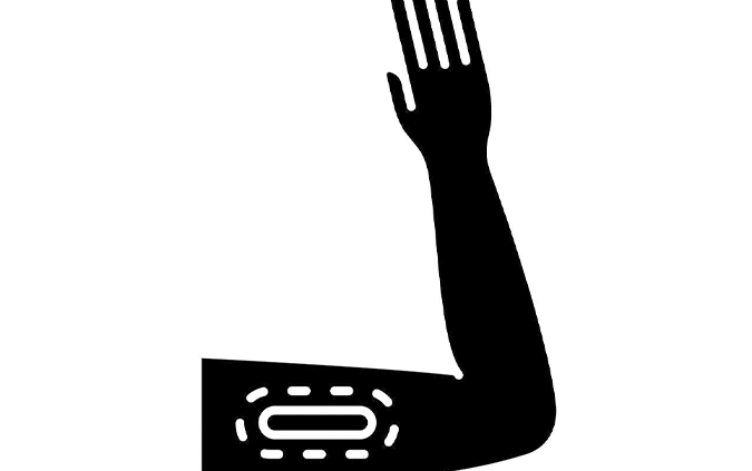 임플라논 시술 통증, 제거 후 임신은 언제부터 가능할까요? 관련 해부 구조 그림